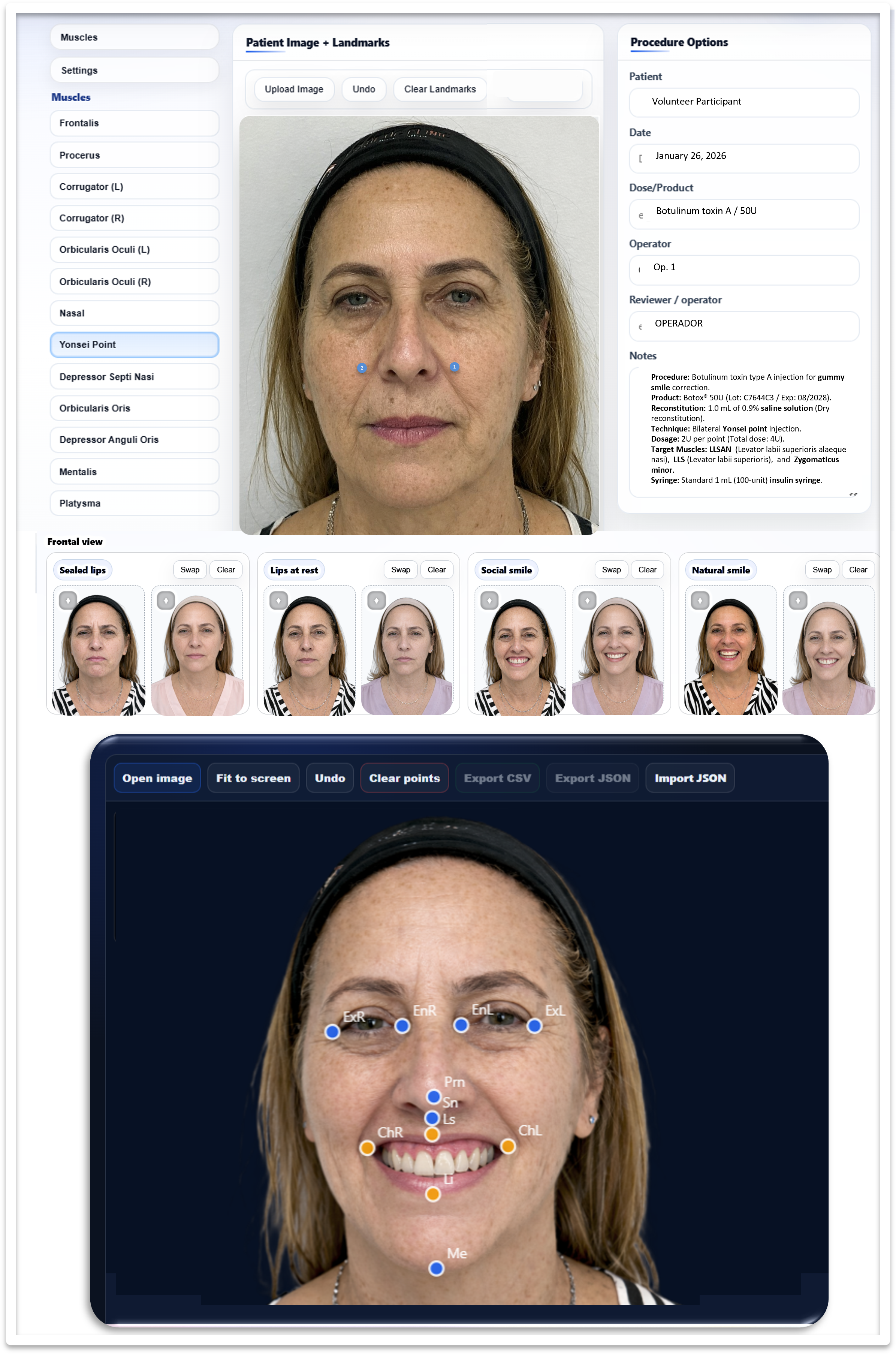 Illustrative auditable digital workflow for gummy-smile documentation