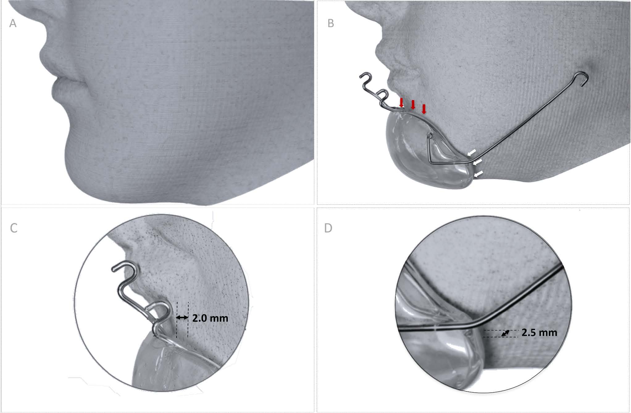 Figure 5 for the Digital Sky Hook article